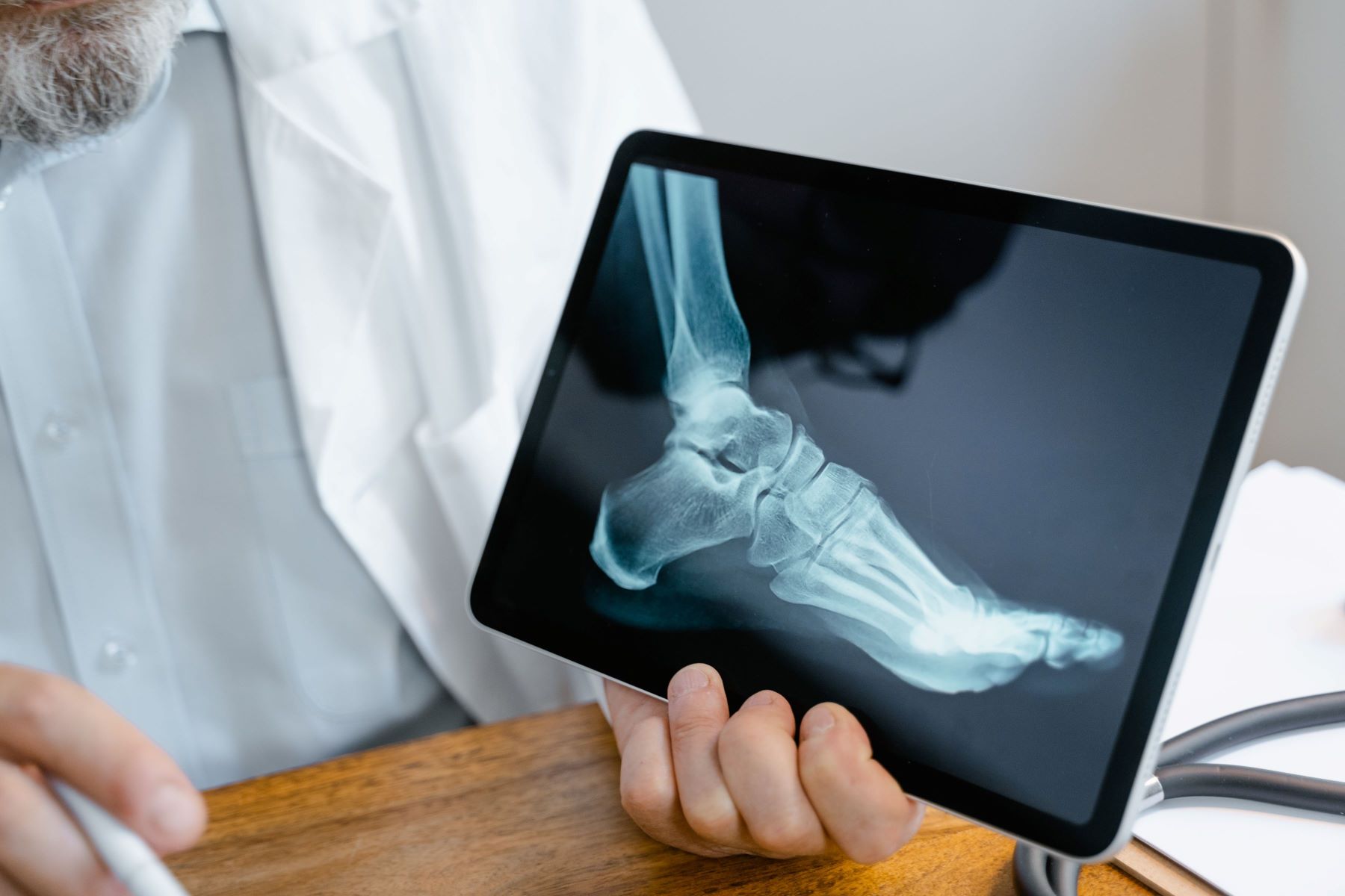 ankle xray